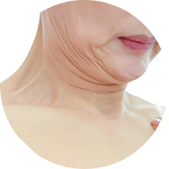 노화